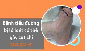 benh-tieu-duong-bi-lo-loet
