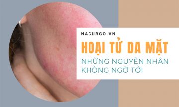hoại tử da mặt, nguyên nhân không ngờ tới