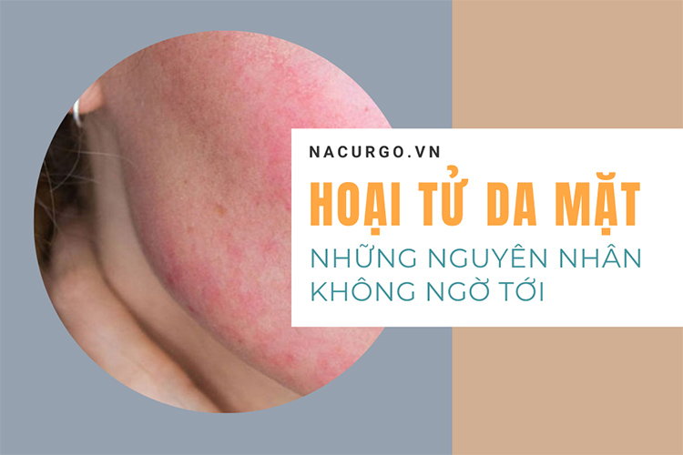 hoại tử da mặt, nguyên nhân không ngờ tới