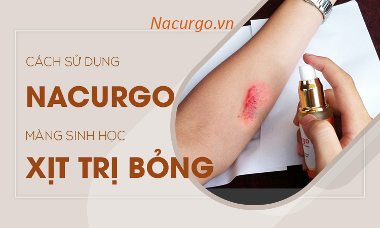 Nacurgo màng sinh học trị bỏng như thế nào? Nacurgo màng sinh học trị bỏng như thế nào?