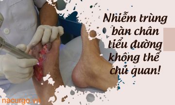 nhiem-trung-ban-chan-tieu-duong