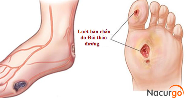 vi-sao-can-cham-soc