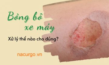 bong-bo-xe-may