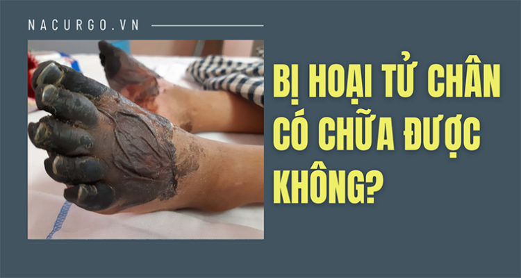 Hoại tử chân có chữa được không?