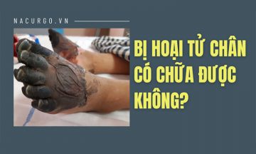 Bị hoại tử chân có chữa được không?