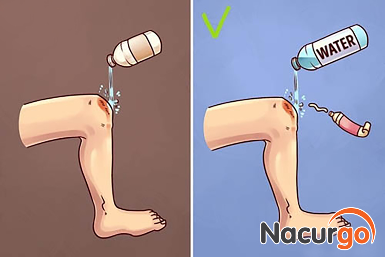 Sử dụng nước tinh khiết để rửa vết thương