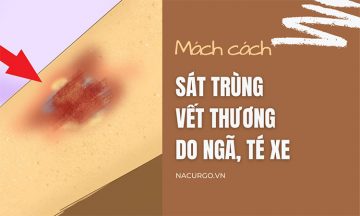 Mách bạn cách sát trùng vết thương ngoài da do ngã, té xe chuẩn