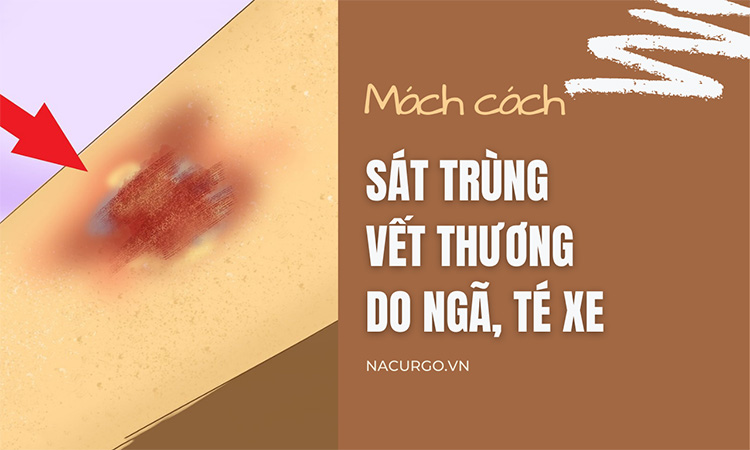 Mách bạn cách sát trùng vết thương ngoài da do ngã, té xe chuẩn
