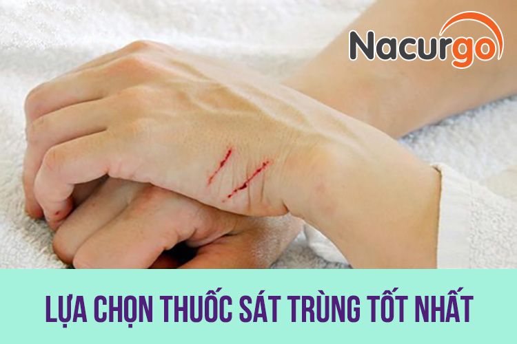 Tiêu chí lựa chọn thuốc sát trùng là gì?