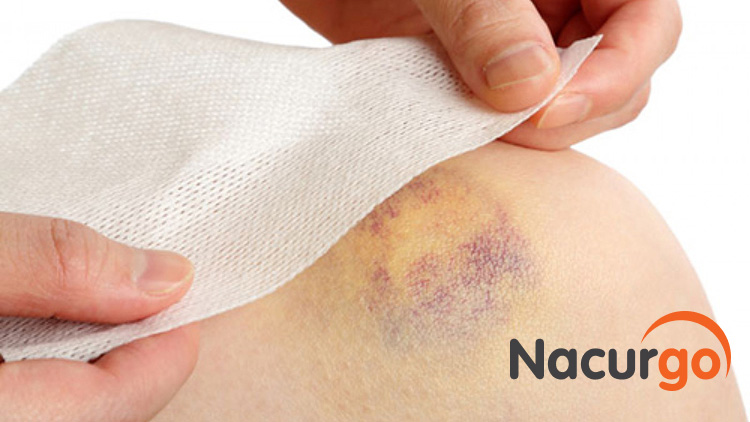 Nên sử dụng sát khuẩn vết thương nông 