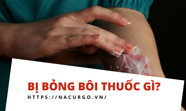 Bị bỏng bôi thuốc gì?