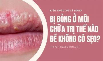 bỊ bỏng môi chữa tri như thế nào?