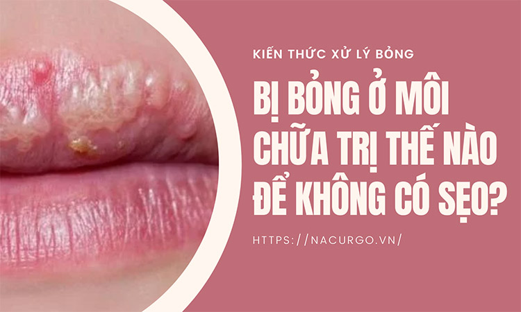 bỊ bỏng môi chữa tri như thế nào?