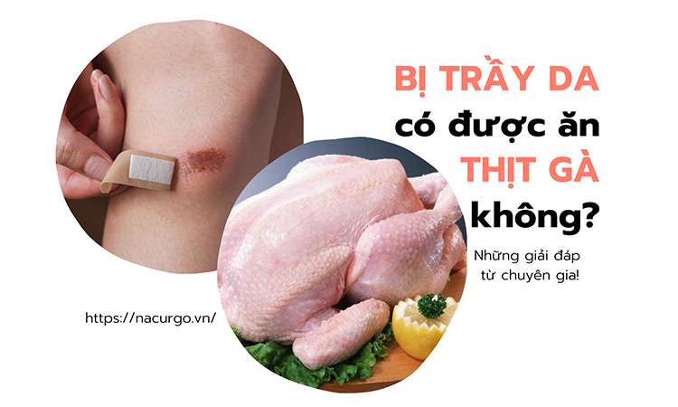 Bị trầy da có ăn được thịt gà không?