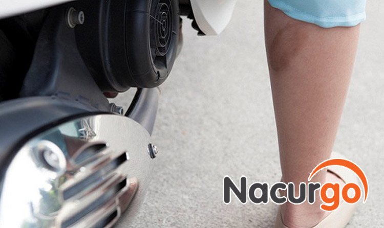 Đặc điểm của vết bỏng bô xe máy