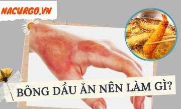 bong-dau-an-nen-lam-gi