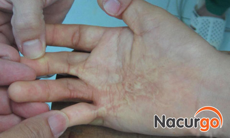 Có thể gây nguy hiểm mất một phần chức năng của cơ thể