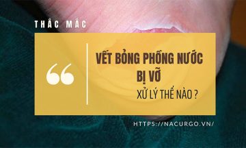 Vết bỏng phỏng nước bị vỡ