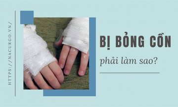 Bị bỏng cồn phải làm sao?