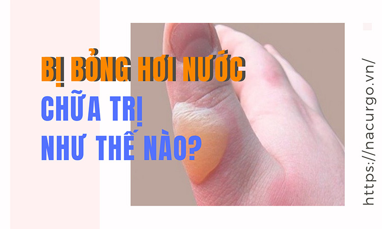 Bị bỏng hơi nước chữa trị như thế nào