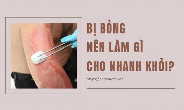 Bị bỏng phải làm sao cho nhanh khỏi