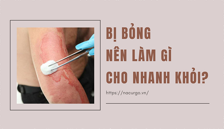 Bị bỏng phải làm sao cho nhanh khỏi