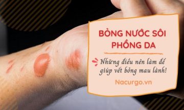 bong-nuoc-soi-phong-da