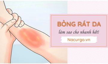 cach-tri-bong-rat-da