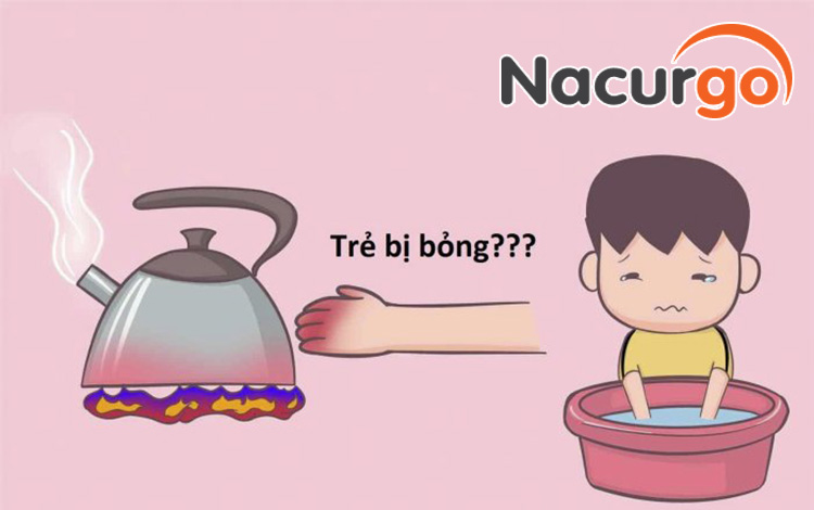 Không phải nước sôi mới có thể gây bỏng cho bé