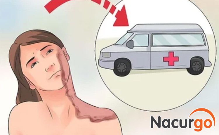 Bạn nên gọi cấp cứu để được nhân viên y tế hướng dẫn sơ cứu cụ thể
