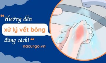 huong-dan-xu-ly-vet-bong