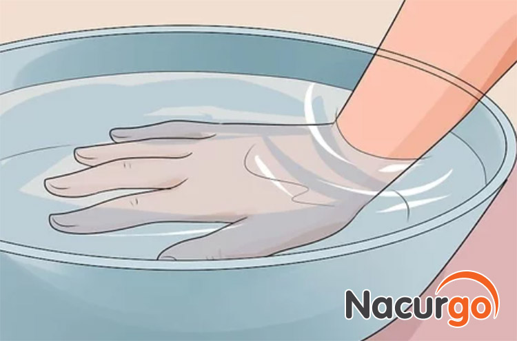 Ngâm vết bỏng vào nước mát giúp hạn chế tổn thương