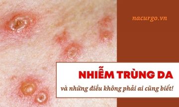 nhiem-trung-da