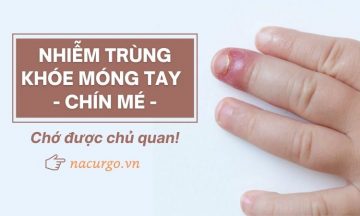 nhiem-trung-khoe-mong-tay