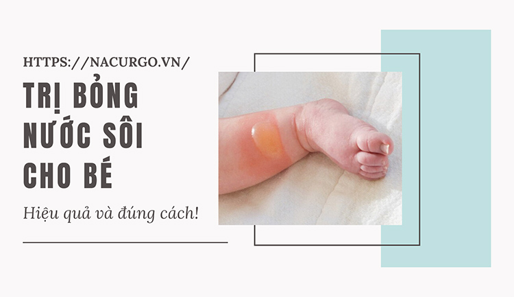 Trị bỏng nước sôi cho bé
