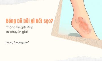 Bỏng bô xe máy bôi gì hết sẹo
