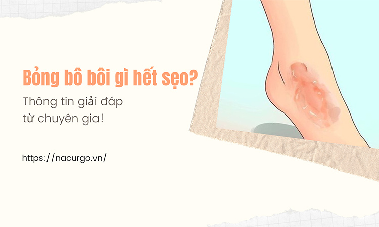 Bỏng bô xe máy bôi gì hết sẹo