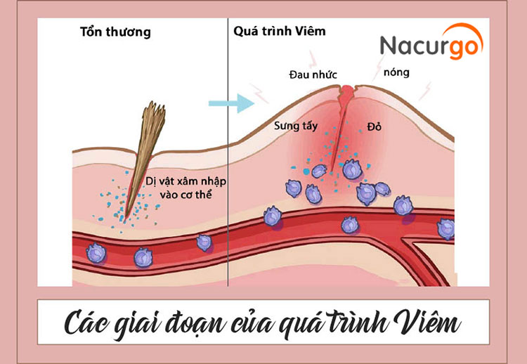 cac-giai-doan-viem