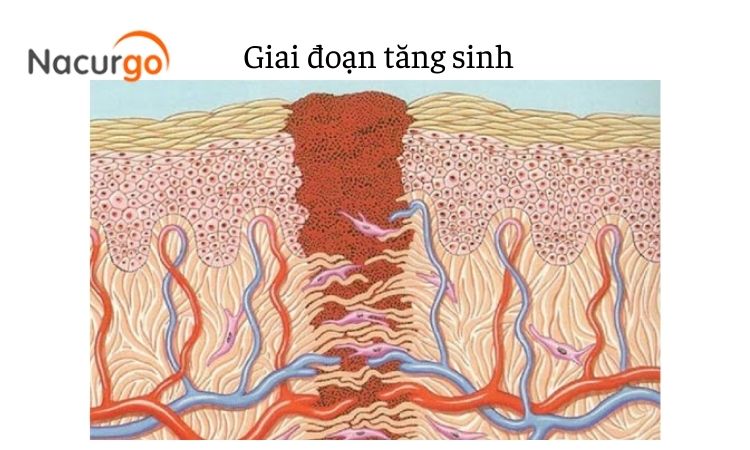 Giai-doan-keo-da-non