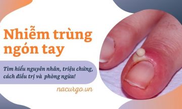 nhiem-trung-ngon-tay