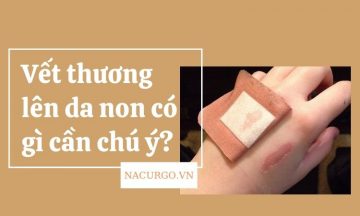 vet-thuong-len-da-non