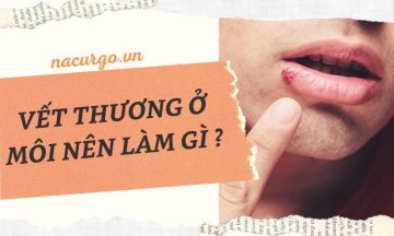 bi-vet-thuong-o-moi