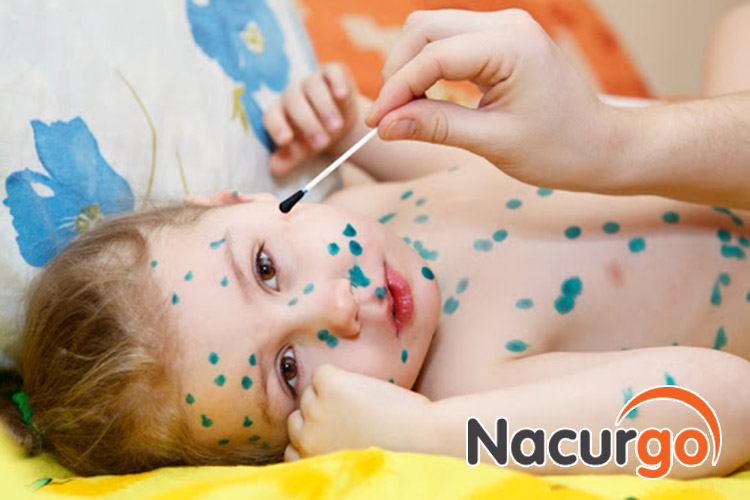 Bôi thuốc cho trẻ theo chỉ định của bác sĩ