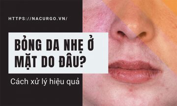 bong dạ nhẹ ở da mặt