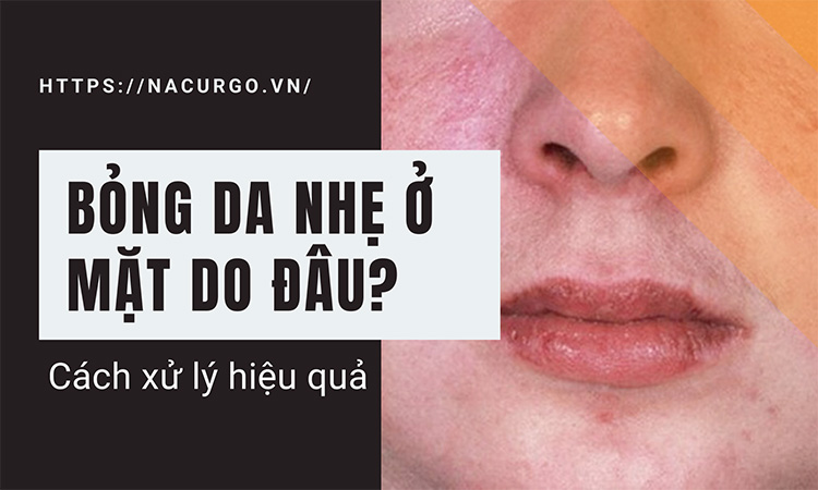 bong dạ nhẹ ở da mặt