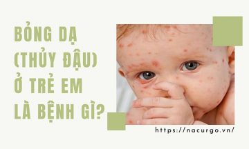 Bỏng dạ (phỏng rạ, thủy đậu) ở trẻ em là bệnh gì