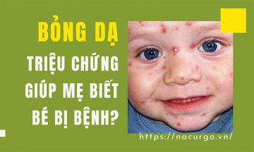Bỏng da triệu chứng biết trẻ mắc bệnh