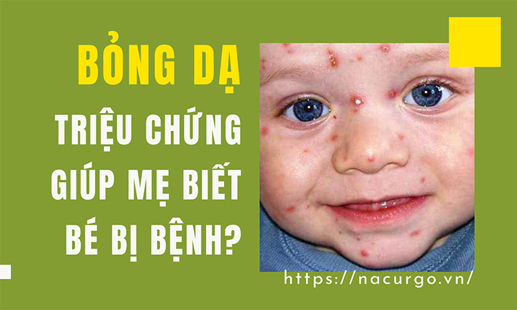 Bỏng da triệu chứng biết trẻ mắc bệnh