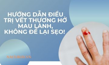 cach-dieu-tri-vet-thuong-ho