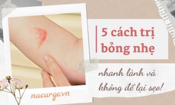 cach-tri-bong-nhe